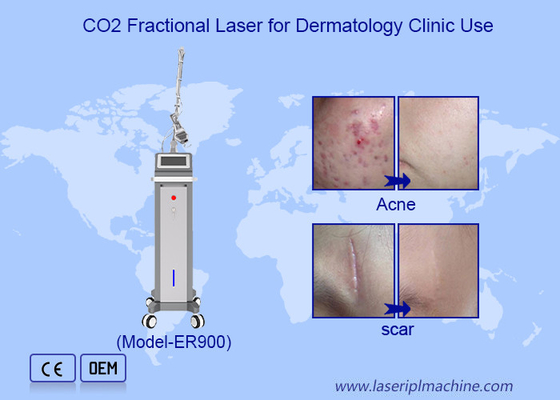 10600nm Fractionele Ultrapulsed Co2 Laser Skin Resurfacing Machine